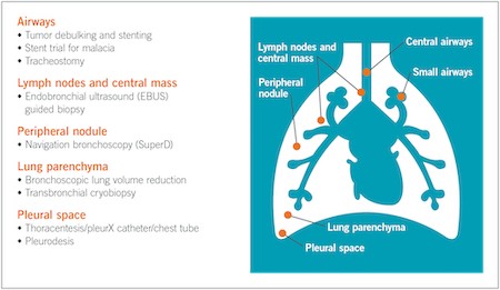 An annotated graph of lung structure